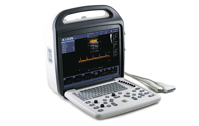 Υπέρηχος Color Doppler 15